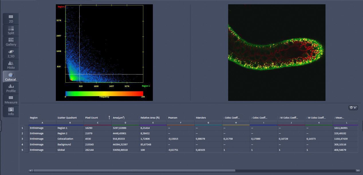 Logiciel Zen Core Zeiss - Logiciel de Microscopie Zeiss — vue 3